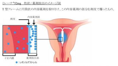 ミレーナ(R)