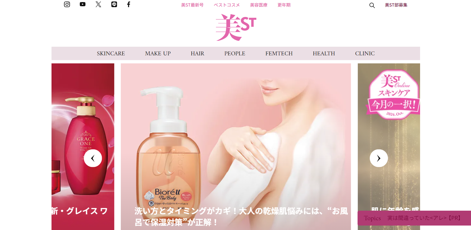 美ST