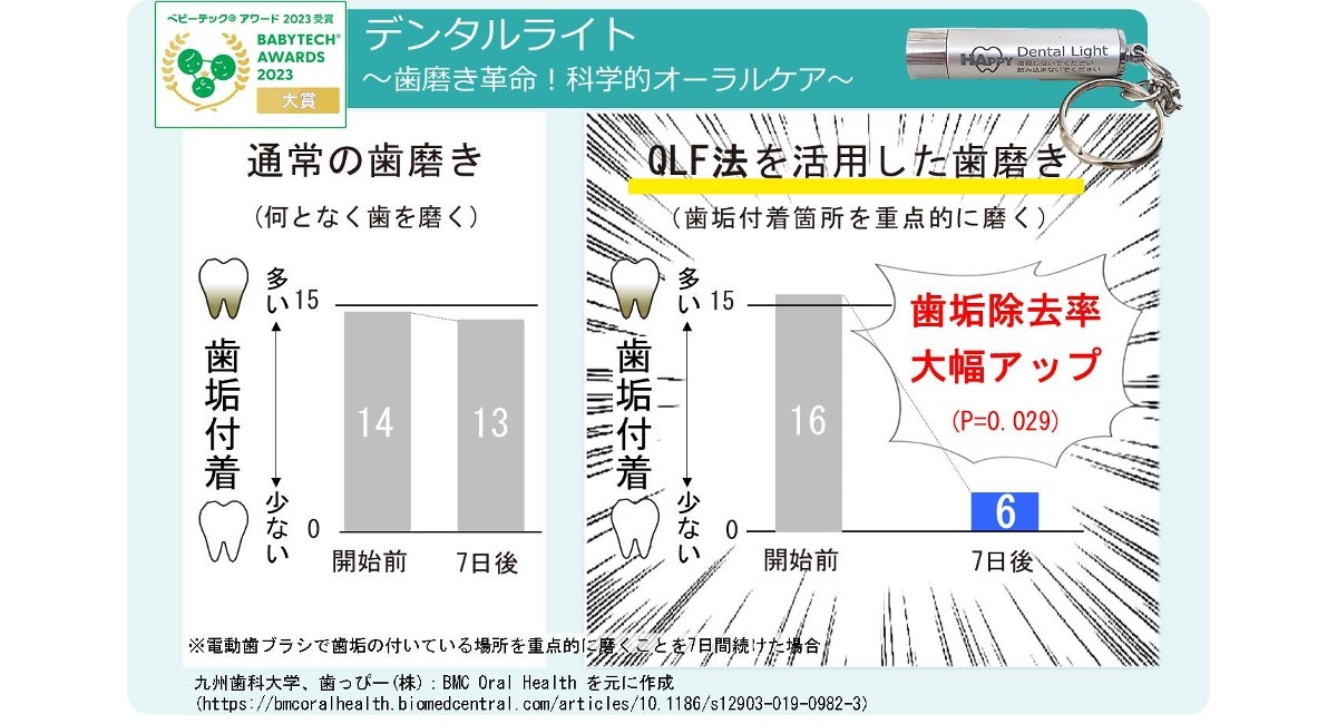 デンタルライト