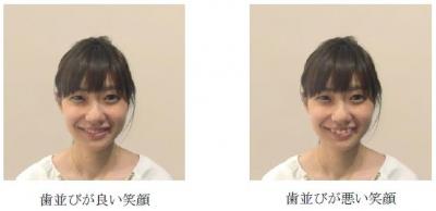 歯並び
