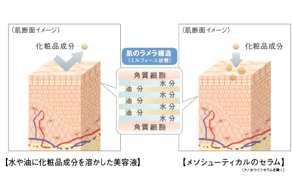 VC22セラム