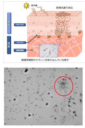 真皮にできたシミ